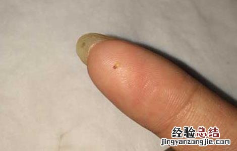 跳蚤怕什么东西??有土方法吗? 跳蚤怕什么东西