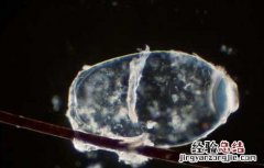 用醋能让虱子卵脱落吗 用醋能让虱子卵脱落吗