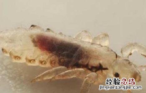 去虱子最简单的方法醋 去虱子最简单的方法