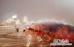 去虱子最简单的方法醋 去虱子最简单的方法