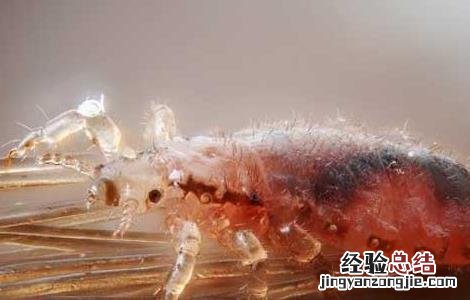 去虱子最简单的方法醋 去虱子最简单的方法