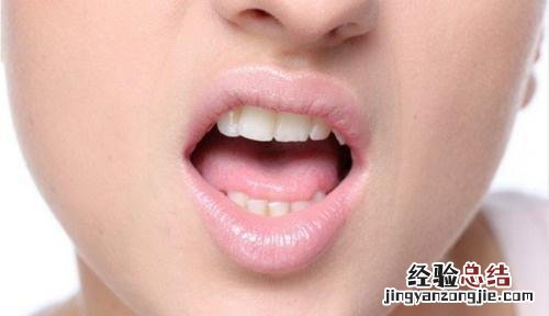 病毒性口腔疱疹能自愈吗 病毒性口腔疱疹