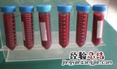 血清是什么 血清的主要成分是什么