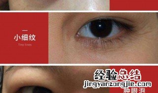 黑眼袋如何去除 黑眼袋怎么去除