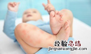 一到冬天晚上身上就痒怎么回事 冬天每天晚上身上很痒