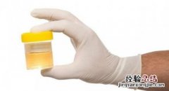 尿检ph值5.0正常吗 尿检ph值