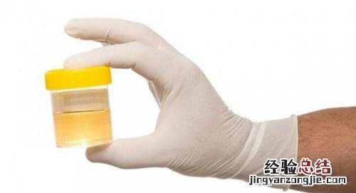 尿检ph值5.0正常吗 尿检ph值