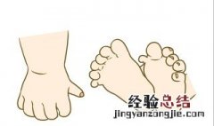 婴儿多指有什么寓意 什么是婴儿多指