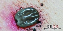 蜱虫咬后症状 人被蜱虫咬后症状