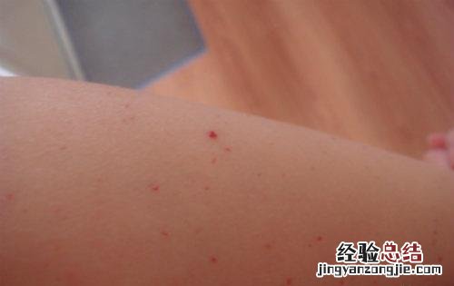 身上长小红点的原因 身上起红色点点是怎么回事