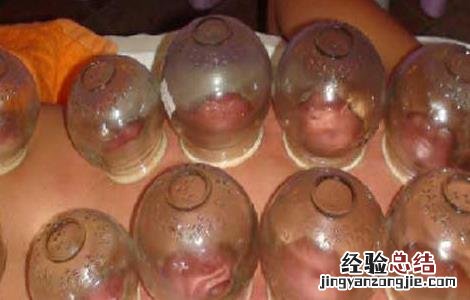 拔罐减肥真的有效吗知乎 拔罐减肥真的有效吗