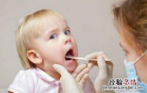 扁桃体发炎是什么样子 扁桃体发炎