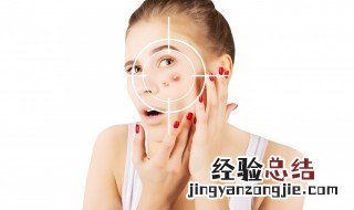 脸上爱长痘是什么情况引起的 脸上爱长痘是什么情况