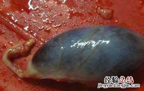 猪胆的功效与作用 猪胆膏的功效与作用