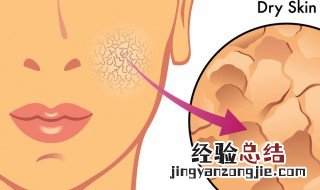 角质是什么 角质有什么作用