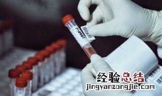 感冒能做核酸检测吗 感冒能不能做核酸检测
