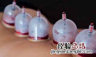 拔罐可以去湿气吗 拔罐可不可以去湿气