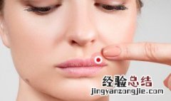 嘴唇经常发干是什么原因 嘴唇经常发干的原因分析