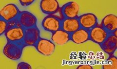 天花是什么病 天花发病时有什么特点