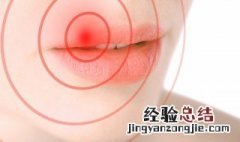 夏天喝黄芪上火吗 夏季喝黄芪上火吗