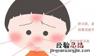 痘痘皮肤如何护理 可以使用什么东西护理