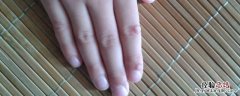 倒数第二个手指叫什么 第二个手指叫什么