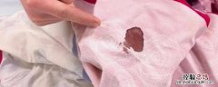 衣服上的血渍如何去掉 衣服上的血渍怎样才能去掉