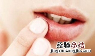 打喷嚏嘴唇干裂怎么办 打喷嚏嘴唇干裂怎么办吃什么药