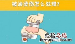 油烫伤后怎么处理 须做好这三步