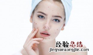 水痘是天花吗 水痘和天花一样吗