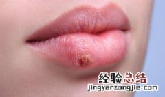 上火喝什么茶好 上火喝茶可以吗