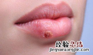 上火喝什么茶好 上火喝茶可以吗