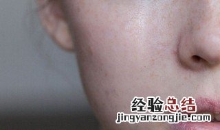 脸上长红痘痘发痒是怎么回事 春季脸上长痘痘红痒是怎么回事