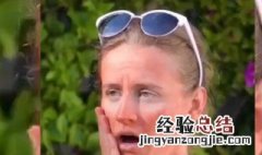 脸部晒伤后如何修复皮肤 脸部晒伤后如何修复