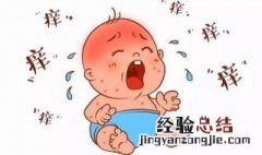 宝宝身上长痘痘的处理方法 宝宝身体长痘痘怎么办