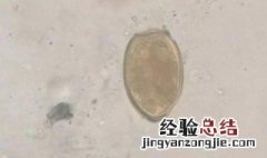 线虫卵壳中能保持水分防止虫卵干燥的是什么 怎么保持水分