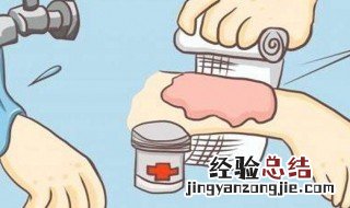 油炸了手怎么处理 油炸到手怎么处理