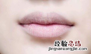阳了嘴巴起皮怎么办 嘴巴起皮怎么办