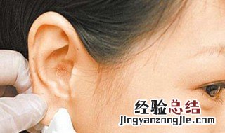 打耳洞发炎了怎么办 打耳洞发炎了怎么办要几天才好