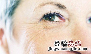 如何淡化眼部细纹图片 如何淡化眼部细纹