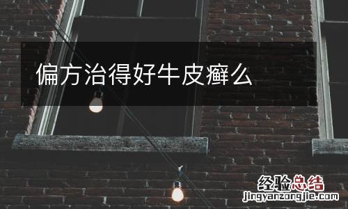 偏方治得好牛皮癣么