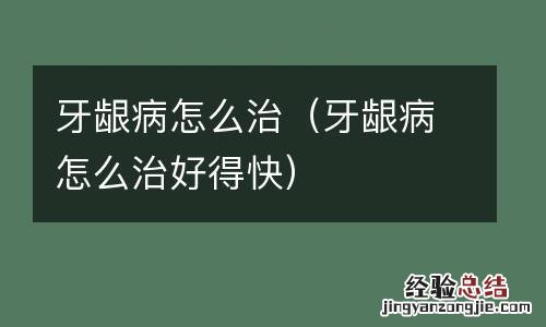 牙龈病怎么治好得快 牙龈病怎么治