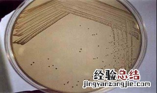 在平板划线法中为什么每次都要灼烧 平板划线每次划线前都要进行灼烧