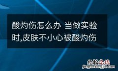 酸灼伤怎么办 当做实验时,皮肤不小心被酸灼伤怎么办