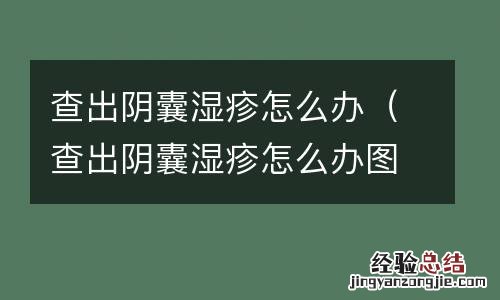 查出阴囊湿疹怎么办图片 查出阴囊湿疹怎么办