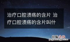 治疗口腔溃疡的含片 治疗口腔溃疡的含片叫什么