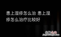 患上湿疹怎么治 患上湿疹怎么治疗比较好