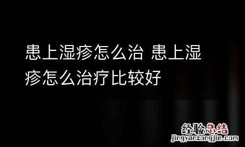 患上湿疹怎么治 患上湿疹怎么治疗比较好