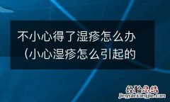 小心湿疹怎么引起的 不小心得了湿疹怎么办