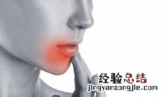 四个方法帮你去去火 怎么能够去火